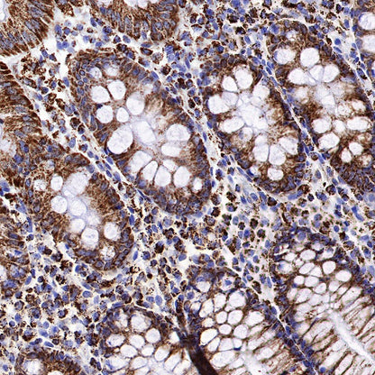 IDH2 Recombinant Rabbit mAb (S-1525-5)