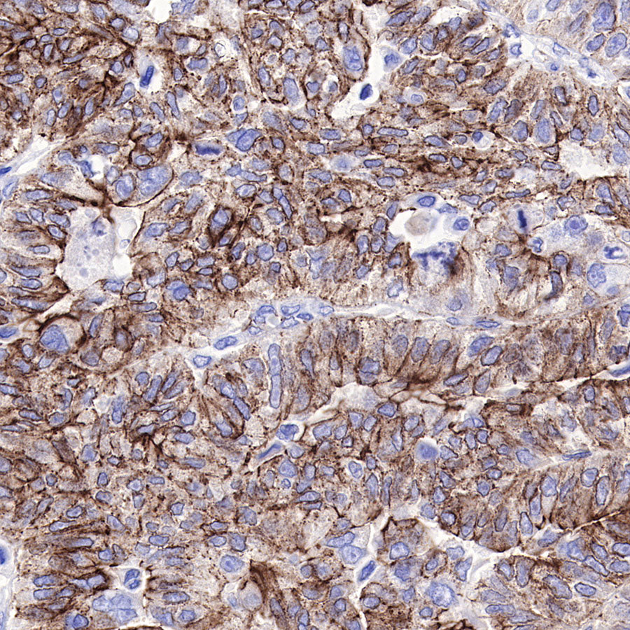 N-Cadherin Recombinant Rabbit mAb (SDT-329-12)