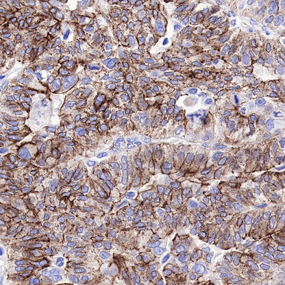 N-Cadherin Recombinant Rabbit mAb (SDT-329-12)