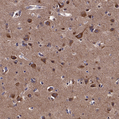 GABARAP Recombinant Rabbit mAb (S-2372-47)