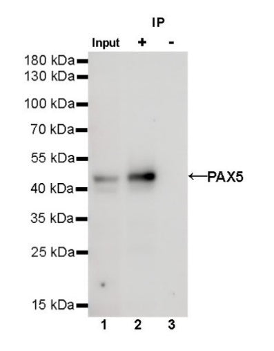 S-RMab® PAX5 Recombinant Rabbit mAb (SDT-R202)