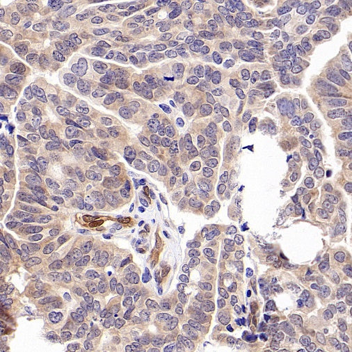 SMAD1 Rabbit Polyclonal antibody