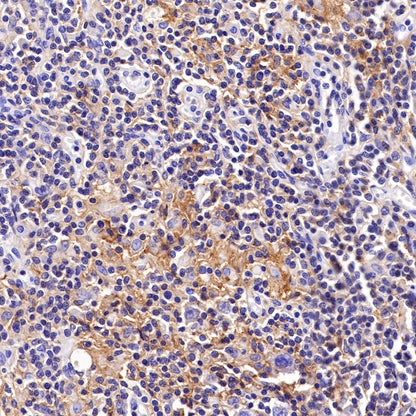 CD48 Recombinant Rabbit mAb (S-R265)