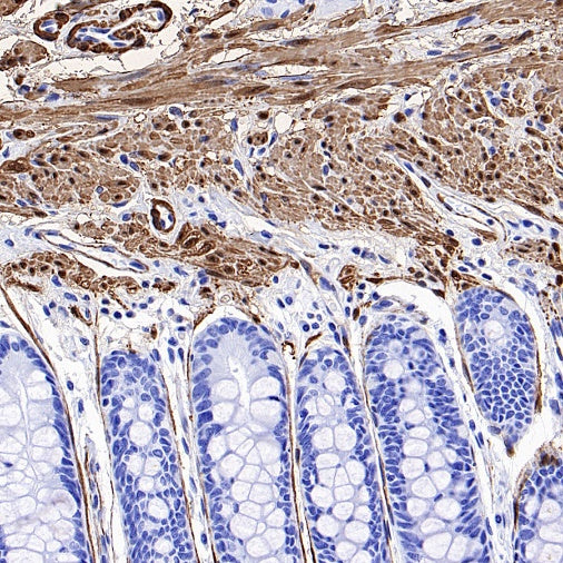 TAGLN/Transgelin Recombinant Rabbit mAb (S-1715-59)