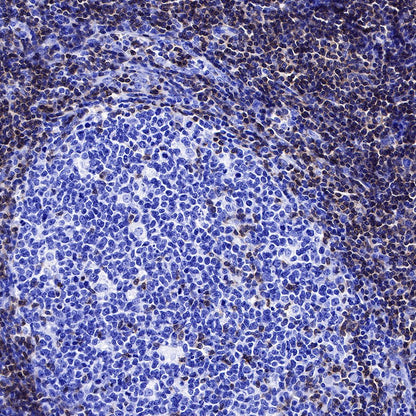CD3 epsilon Recombinant Rabbit mAb (SDT-241-49)