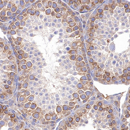 TBK1/NAK Recombinant Rabbit mAb (S-658-50)