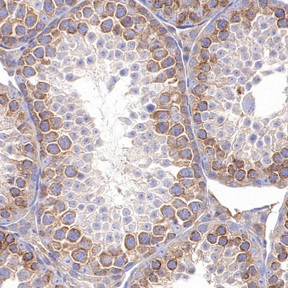 TBK1/NAK Recombinant Rabbit mAb (S-658-50)