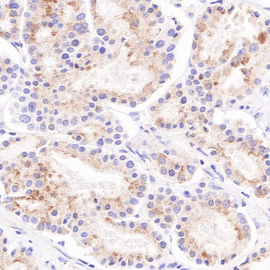 AMACR/p504s Recombinant Rabbit mAb (SDT-401-29)