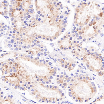 AMACR/p504s Recombinant Rabbit mAb (SDT-401-29)