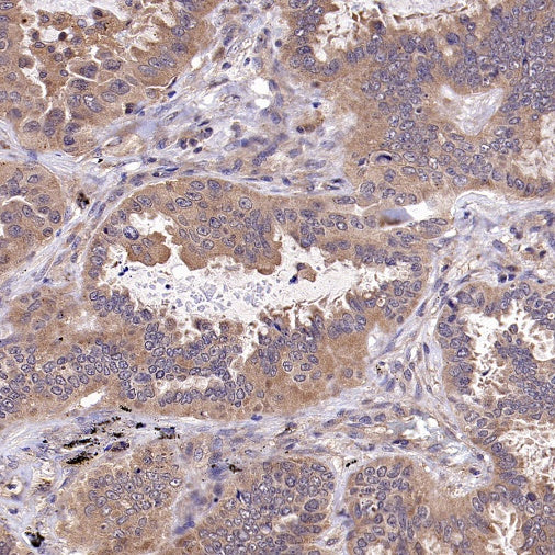 CALHM2 Recombinant Rabbit mAb (S-2671-146)