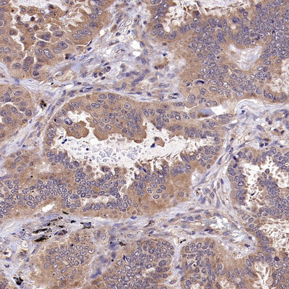 CALHM2 Recombinant Rabbit mAb (S-2671-146)