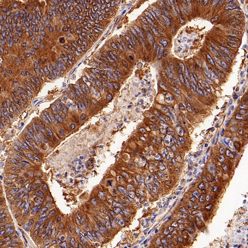 Beta IV Tubulin Rabbit polyclonal antibody
