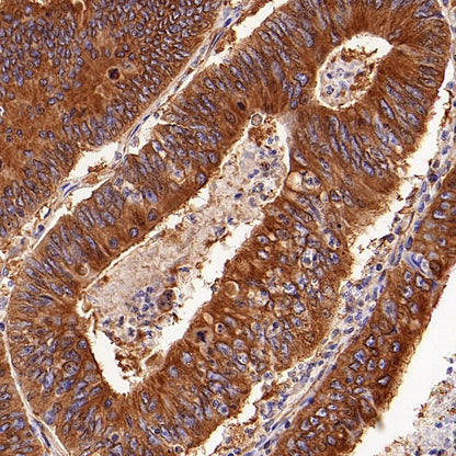 Beta IV Tubulin Rabbit polyclonal antibody