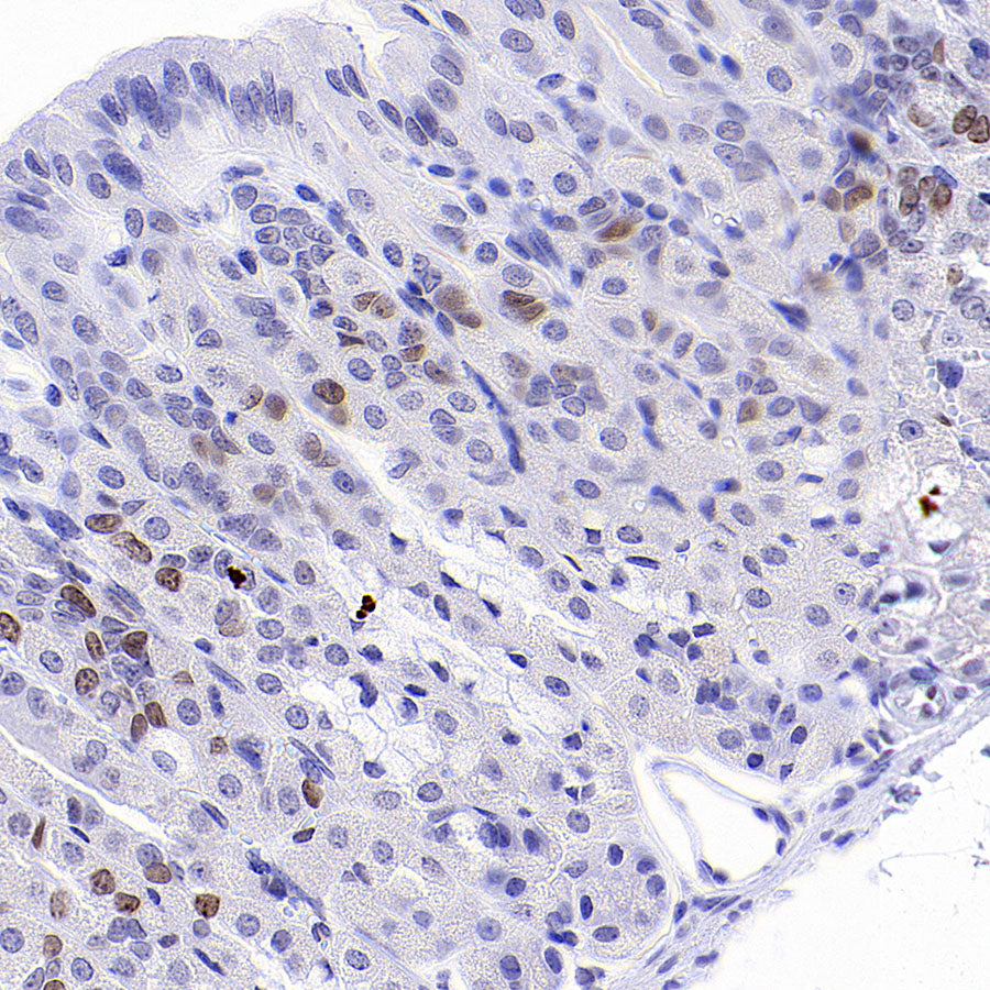 ATAD2 Recombinant Rabbit mAb (S-4145-63)