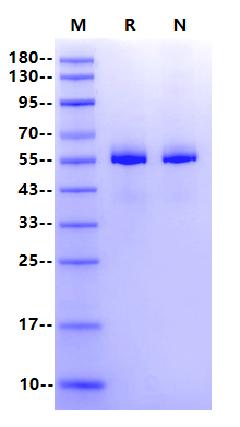 IRAK4 His Tag Protein, Human
