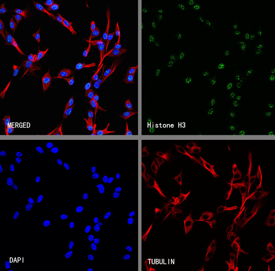 Histone H3 Recombinant Rabbit mAb (S-5672)