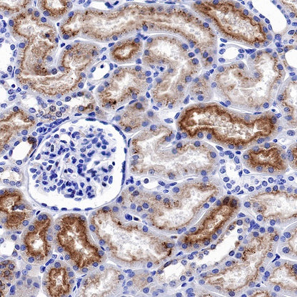 Osteopontin Recombinant Rabbit mAb (S-1005-50)