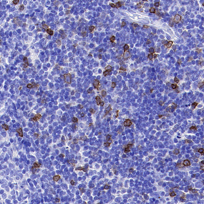 CD134 Recombinant Rabbit mAb (S-4797)