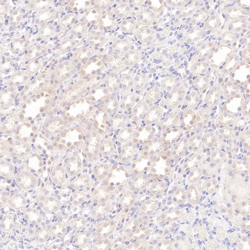 AMPKα Recombinant Rabbit mAb (S-784-68)