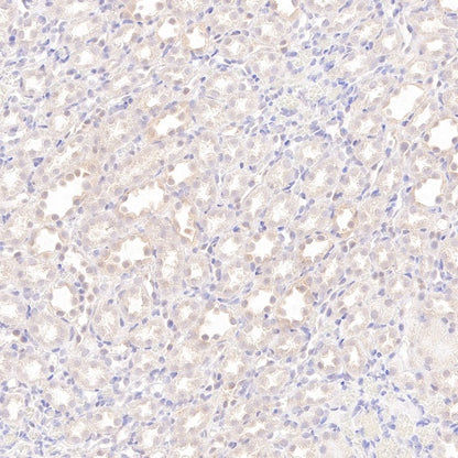 AMPKα Recombinant Rabbit mAb (S-784-68)
