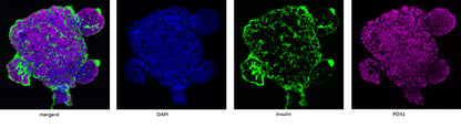 KGF/FGF-7 Protein, Human