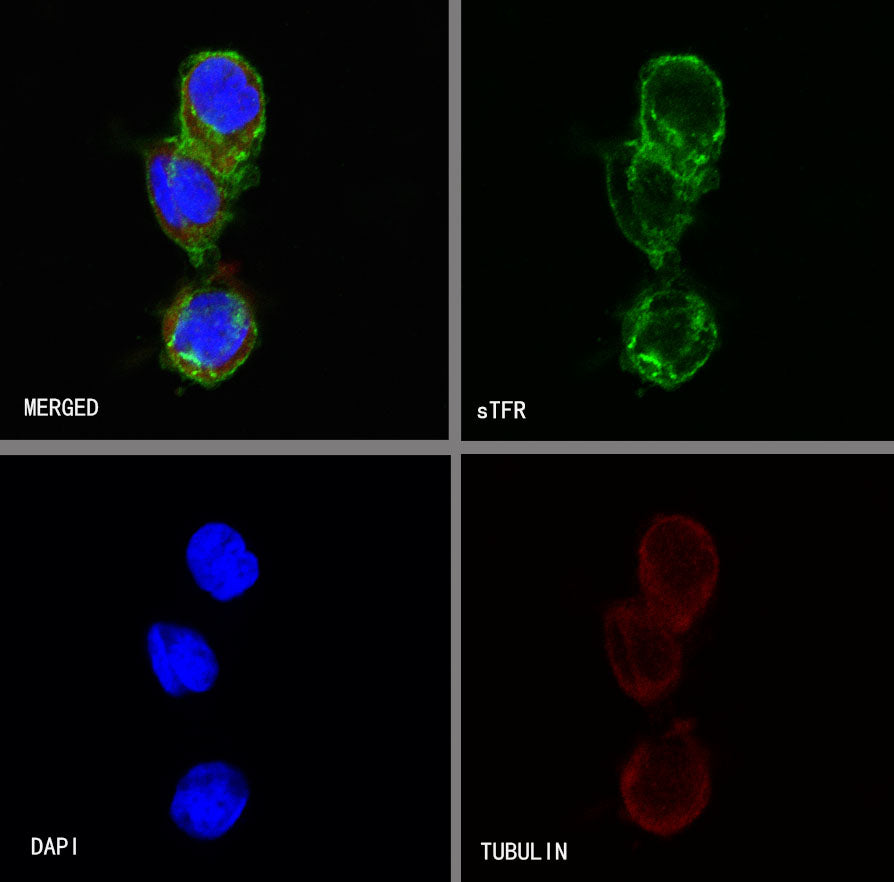 sTfR Recombinant Rabbit mAb (S-612-12)