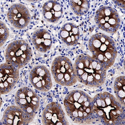 CD66a/CEACAM1 Recombinant Rabbit mAb (S-678-53)