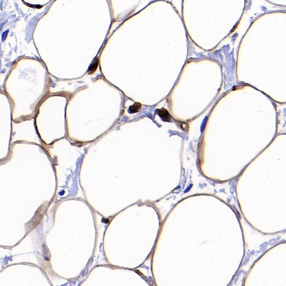 FABP4 Recombinant Rabbit mAb (S-1360-58）