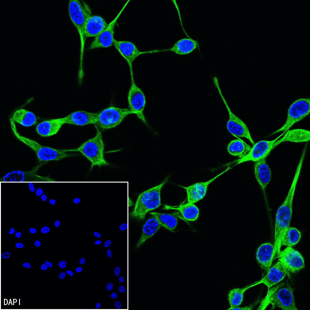 Beta Tubulin Recombinant Mouse mAb (S-5422)