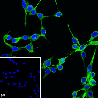 Beta Tubulin Recombinant Mouse mAb (S-5422)
