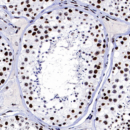 ARID1A Recombinant Rabbit mAb (S-440-62)