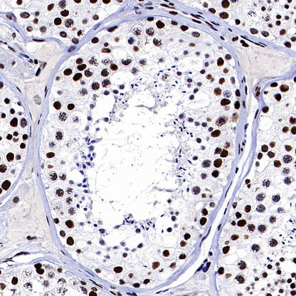 ARID1A Recombinant Rabbit mAb (S-440-62)