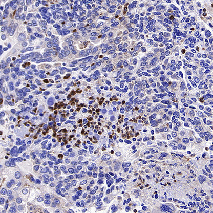 PTPN6 Rabbit Polyclonal Antibody