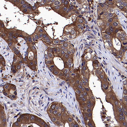 HSP90 Recombinant Mouse mAb (S-5484)