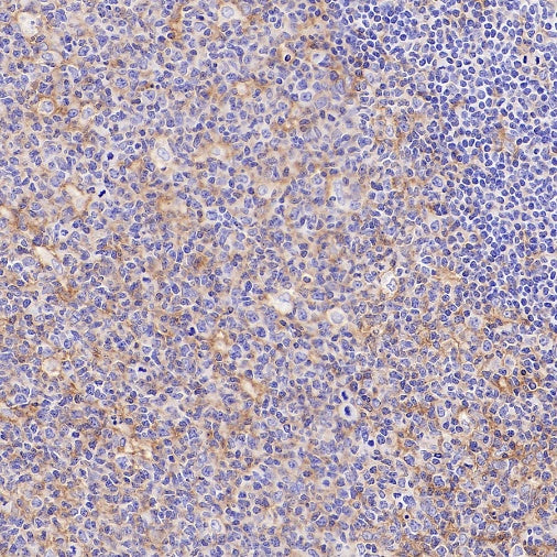NINJ1 Recombinant Rabbit mAb (S-3109-56)