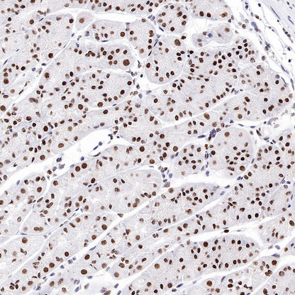 Topoisomerase I/TOP1 Recombinant Rabbit mAb (S-822-60)