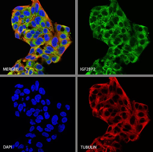 IGF2BP2 Rabbit Polyclonal Antibody