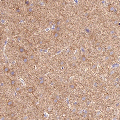 GPHN Recombinant Rabbit mAb (S-3167-63)