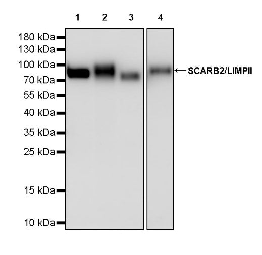 SCARB2/LIMPII Recombinant Rabbit mAb (S-2847-21)
