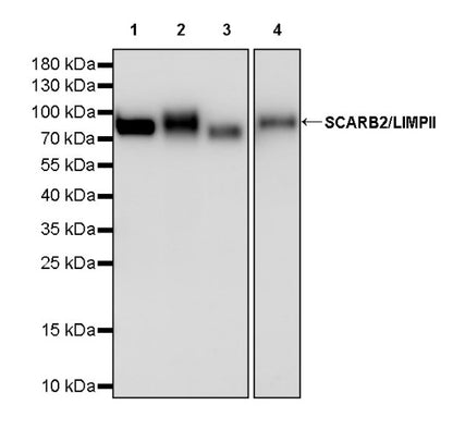 SCARB2/LIMPII Recombinant Rabbit mAb (S-2847-21)