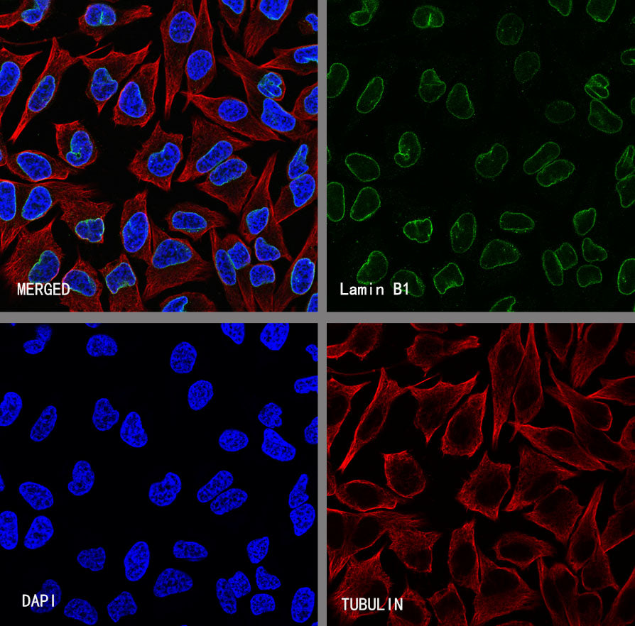 Lamin B1 Recombinant Rabbit mAb (S-5361)