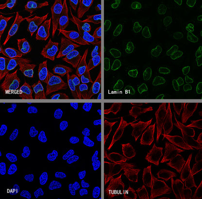 Lamin B1 Recombinant Rabbit mAb (S-5361)