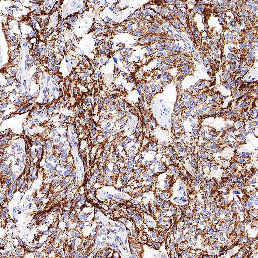 TFAM Recombinant Rabbit mAb