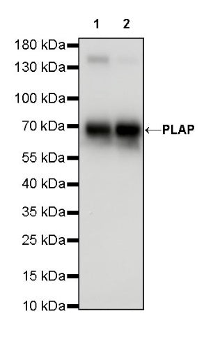 PLAP+ALPI Recombinant Rabbit mAb (SDT-167-155)