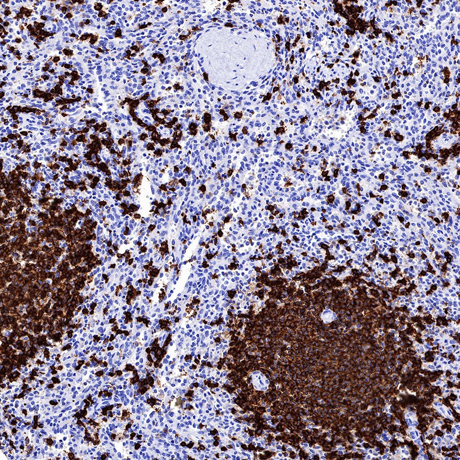 S-RMab® CD20 Recombinant Rabbit mAb,PBS Only (SDT-R133)
