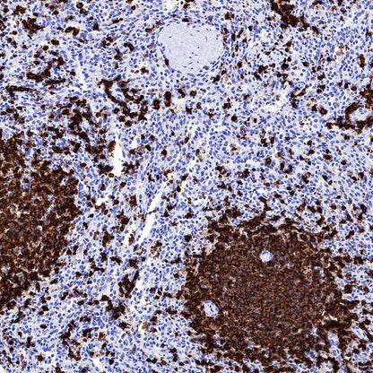 S-RMab® CD20 Recombinant Rabbit mAb,PBS Only (SDT-R133)