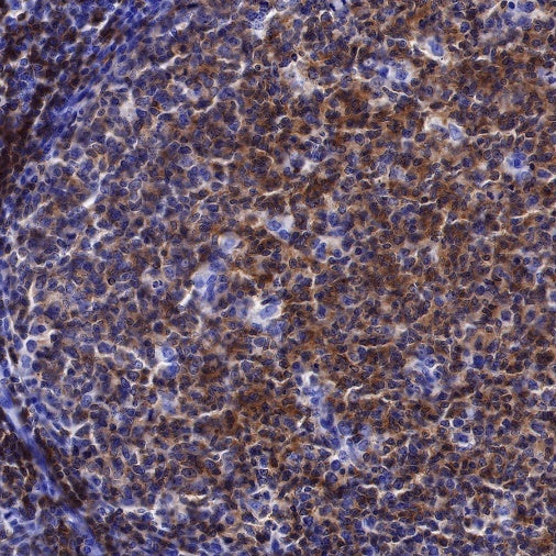 Lck Recombinant Rabbit mAb (SDT-316-15)