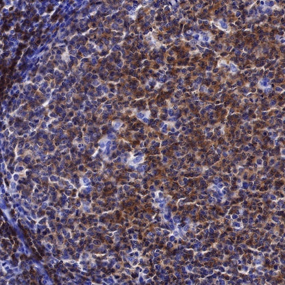 Lck Recombinant Rabbit mAb (SDT-316-15)