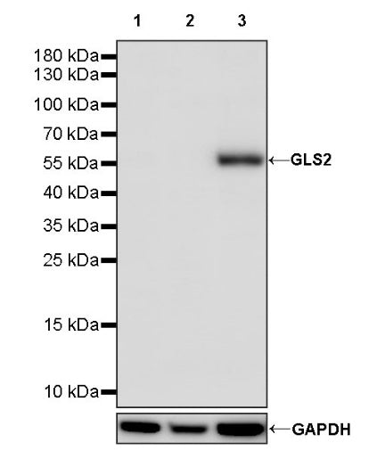 GLS2 Rabbit Polyclonal Antibody