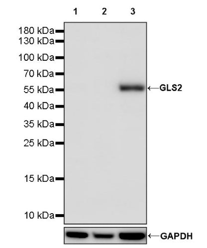 GLS2 Rabbit Polyclonal Antibody